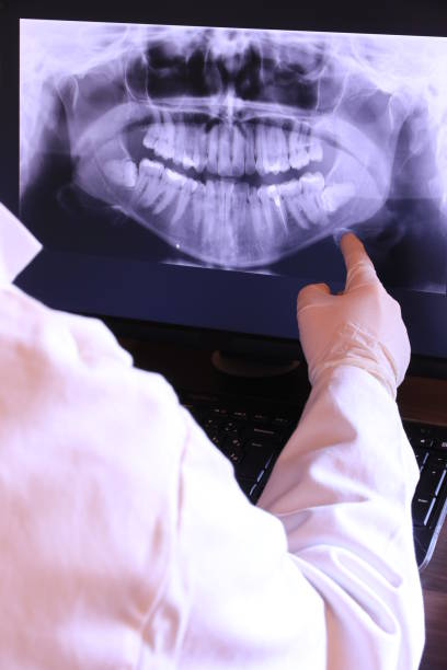 Best Emergency Denture Repair in Wilkes Barre, PA